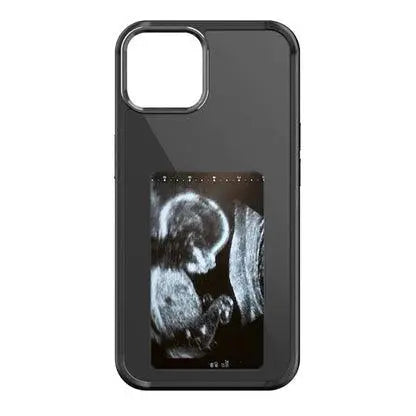 Dijital Telefon Kılıfı,nfc telefon kılıfı