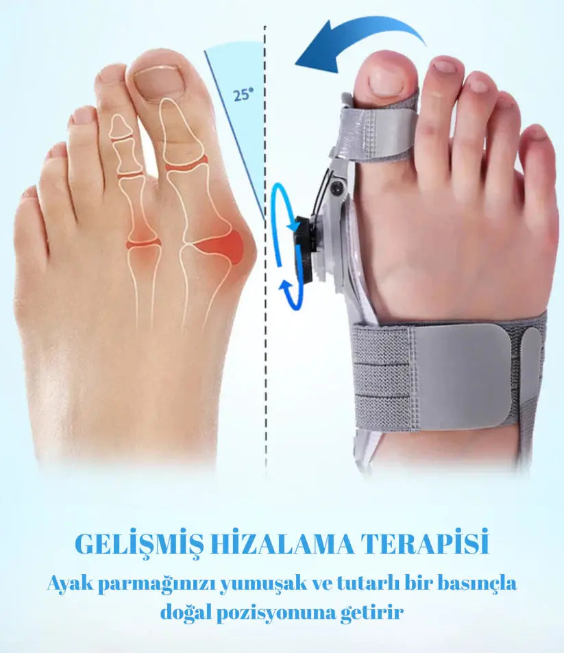Halluks Valgus Düzeltme Aparatı